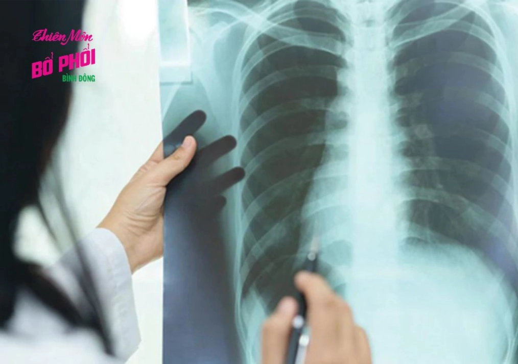 Dấu hiệu cảnh báo cần đi khám khi ho kéo dài